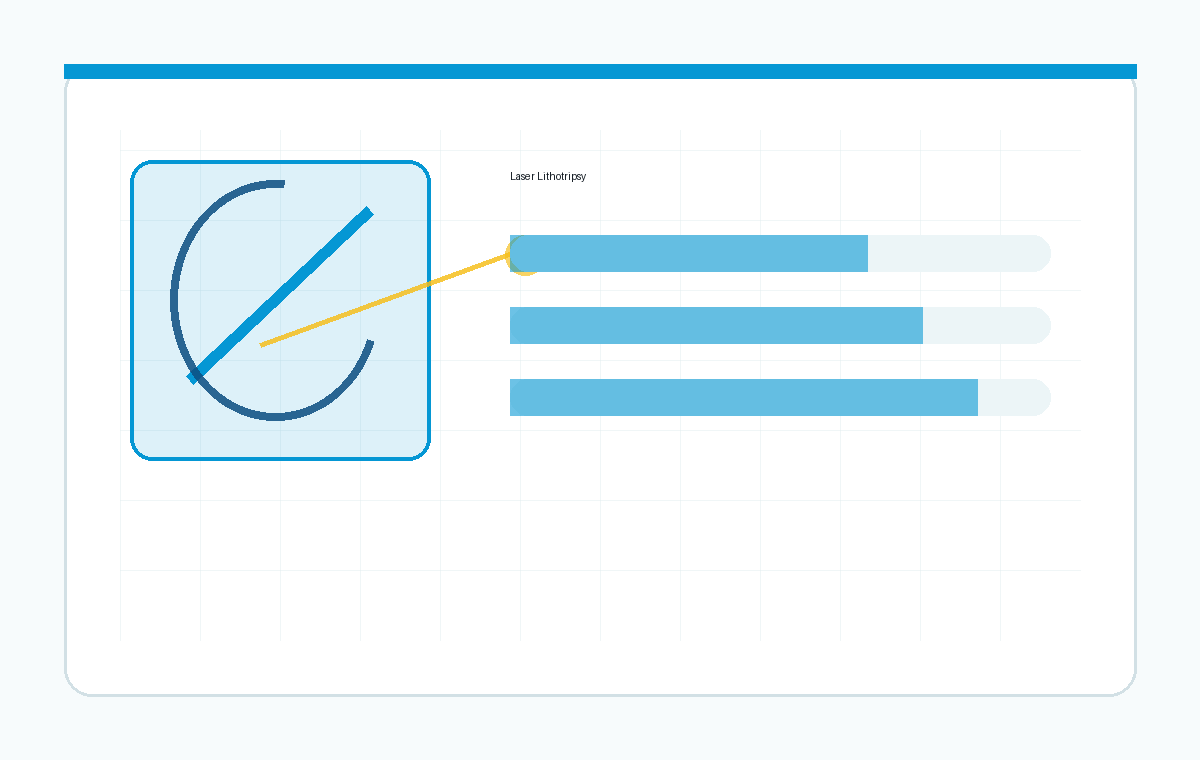 Laser lithotripsy product visual